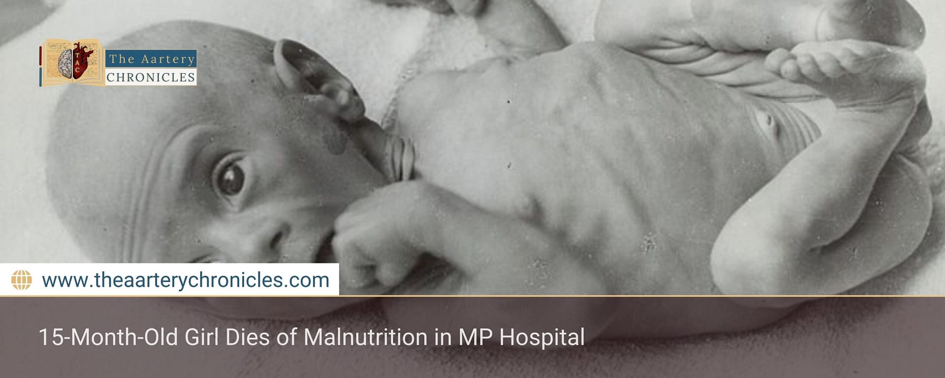 15-Month-Old Girl Dies of Malnutrition in MP Hospital